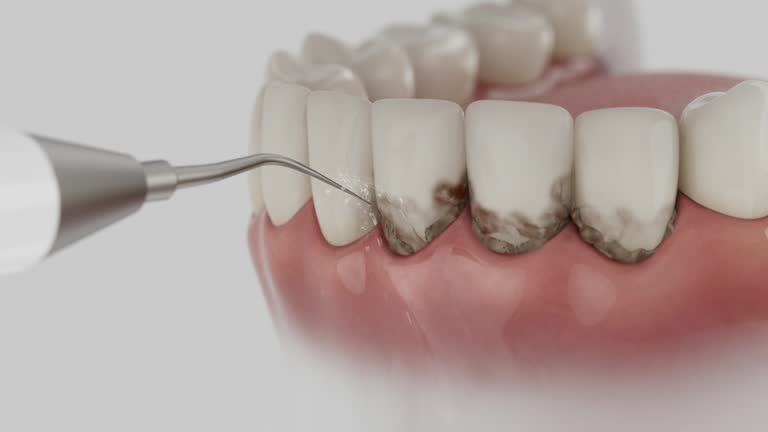 Reliable Teeth Cleaning And Checkup contractor in Caroline County County, VA by Dentist Open Now